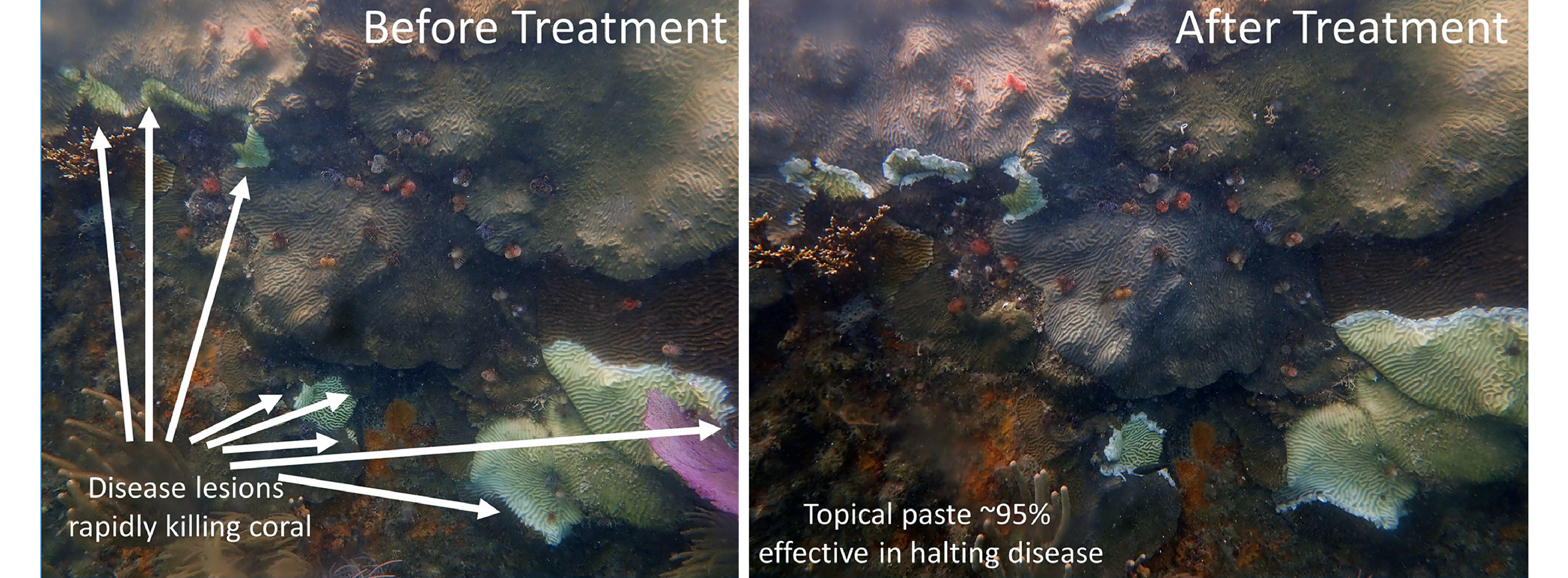 Side-by-side photos showing a close up of numerous corals covering a substrate. On the left, white arrows point to areas of recent mortality that are a lighter color than the adjacent live tissue. On the right, the corals have been treated, as shown by white paste around the lighter color spots.